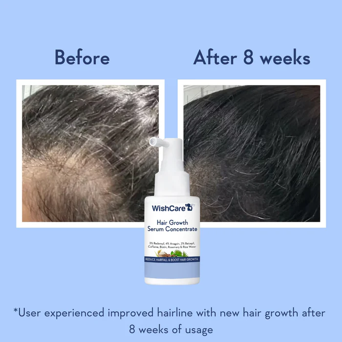 Hair Growth Serum Concentrate With 3% Redensyl, 4% Anagain, Rice Water, Biotin - Image 6
